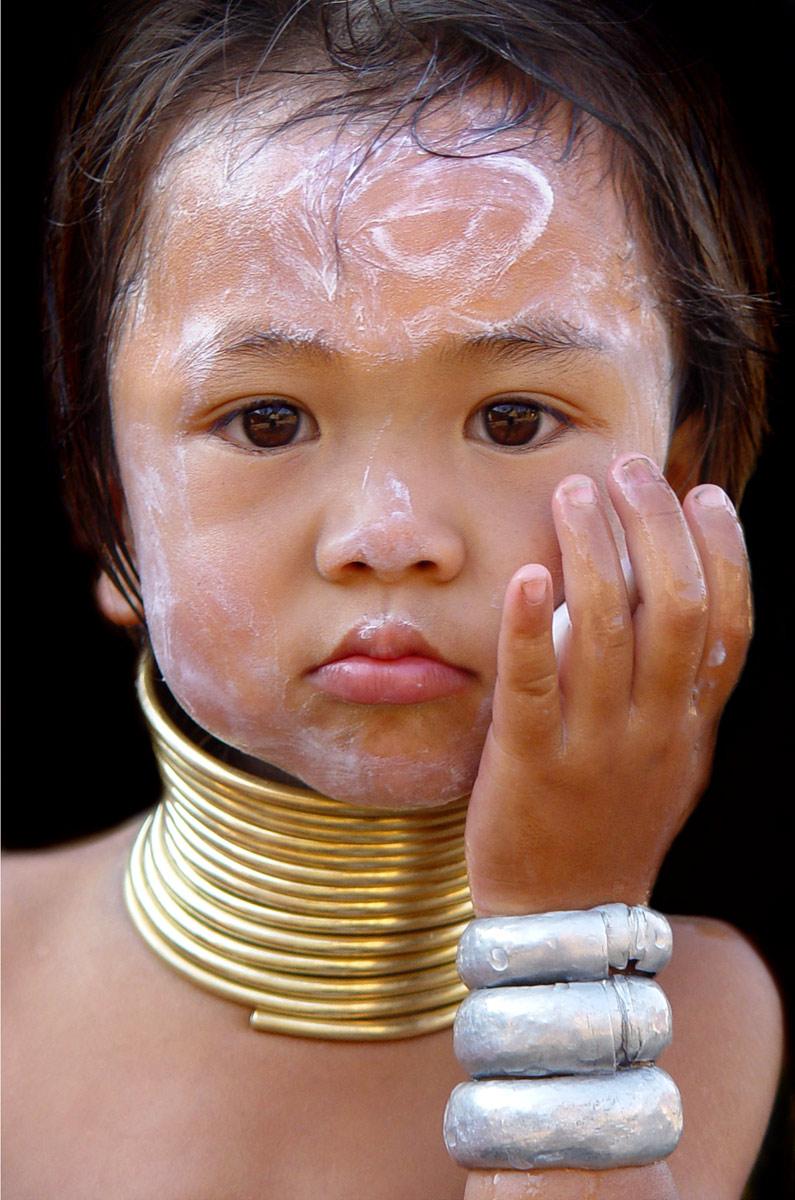 «Long neck» child, Northern Thailand, 2003